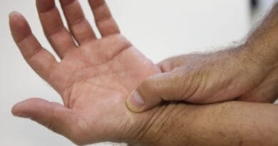 Novas diretrizes ampliam o tratamento de fibromialgia pelo SUS Novas diretrizes ampliam o tratamento de fibromialgia pelo SUS